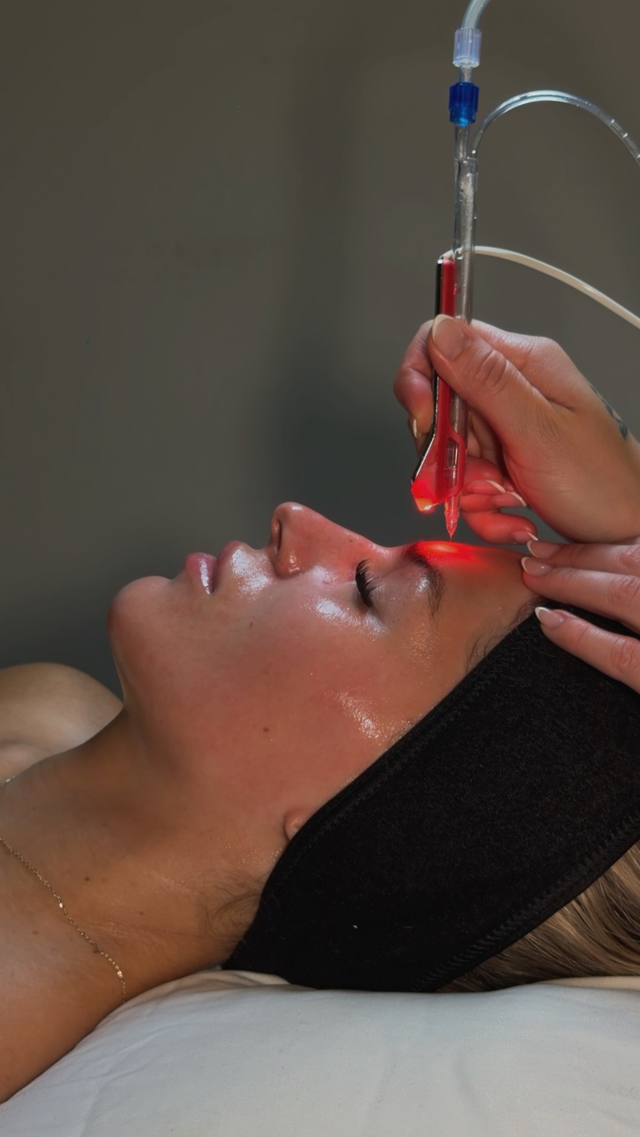 Person receiving a medical treatment with a tube and red liquid, lying down with eyes closed, head on a pillow.